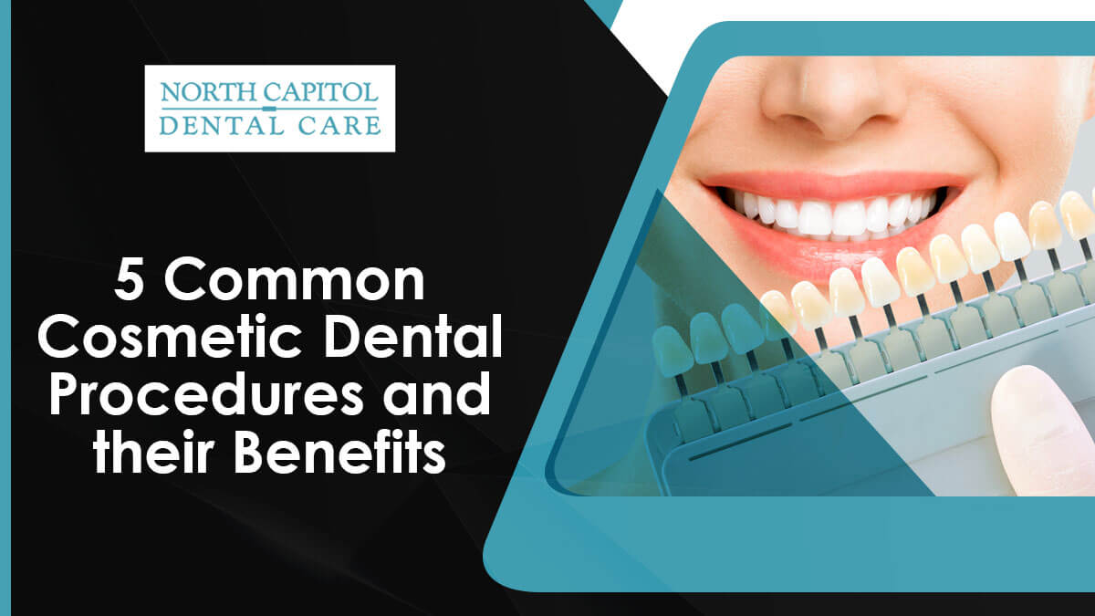 5 Common Cosmetic Dental Procedures And Their Benefits Irina V Ganzha Dds 